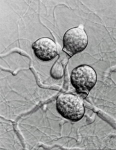 * 圖說：集生多壺菌多中心菌體上二個及三個集生的孢子囊* (攝影 陳淑芬)* 作者：Chen, S. F.拍攝,陳淑芬拍攝* 智財權：陳淑芬