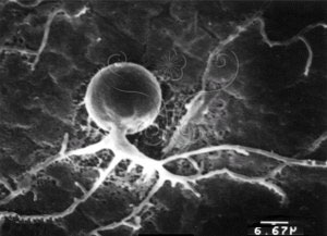 * 圖說：尖絲小壺菌掃描電子顯微鏡下未成熟菌體* (攝影 陳淑芬)* 作者：Chen, S. F.拍攝,陳淑芬拍攝* 智財權：陳淑芬