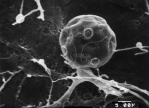 * 圖說：尖絲小壺菌掃描電子顯微鏡下成熟菌體，孢子囊表面有數個釋放乳突* (攝影 陳淑芬)* 作者：Chen, S. F.拍攝,陳淑芬拍攝* 智財權：陳淑芬