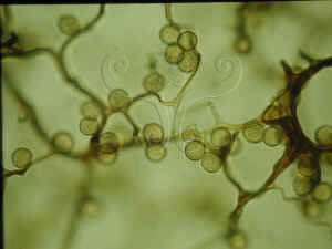 * 圖說：美髮網菌光學顯微鏡下的孢子外觀* (攝影 王也珍)* 作者：王也珍拍攝* 智財權：王也珍