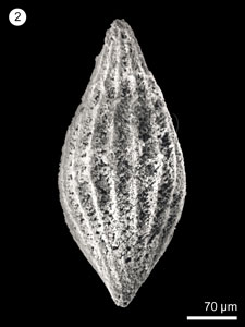 * <i>Archaeodictyomitra lacrimula</i> (Foreman)* 智財權：國立自然科學博物館