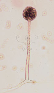 * 圖說：5.在光學顯微鏡下，少孢根霉菌的孢子囊，上面有許多的孢子* 作者：王也珍
