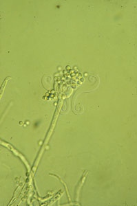 * 圖說：2.顯微鏡下的青黴菌。* 作者：王也珍