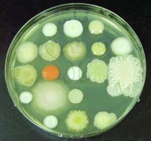 * 圖說：1.不同酵母菌的菌落型態與顏色。* 作者：李清福