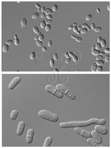 * 圖說：2.不同酵母菌的無性生殖方式。上圖為出芽生殖，下圖為分裂生殖。* 作者：李清福
