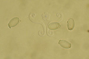 * 圖說：4.顯微鏡下的羊肚菌孢子，兩端有小的油滴* 作者：吳聲華