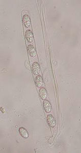 * 圖說：2.盾盤菌的子囊，內含8個孢子* 作者：王也珍