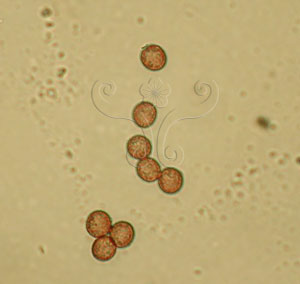* 圖說：2.顯微鏡下的煤絨菌孢子。* 作者：王也珍