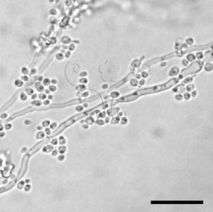 * 圖說：2.Pichia stipitis 於玻片覆蓋培養7天（25℃）後之菌絲形態，刻度為25微米* 作者：李清福