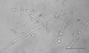 * 圖說：2.Yarrowia lipolytica於玻片覆蓋培養7天（25℃）後之菌絲形態，刻度為50微米* 作者：李清福