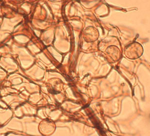 * 圖說：2.在顯微鏡下觀察到的美髮網菌的網狀細毛體和孢子。* 作者：王也珍