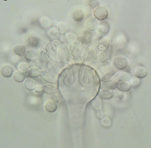 * 圖說：3.Eurotium無性世代Aspergillus之分生孢子表面具刺狀突起。* 作者：謝松源