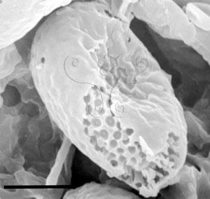 * 圖說：2.掃描式電子顯微鏡觀察鬆芝擔孢子內層壁表面呈孔狀。* 作者：吳聲華