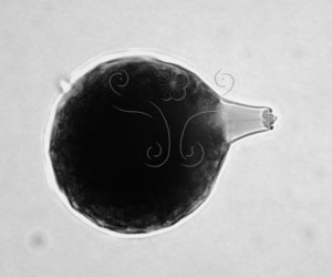 * 圖說：2.海生疫病菌Halophytophthora masteri 的游走孢子囊(光學顯微鏡)。* 作者：謝松源