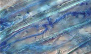 * 圖說：3.光學顯微鏡檢查甘藍黃葉病植株莖基部維管束切片，菌絲存在維管束內生長的情形。* 作者：莊茗凱、黃振文