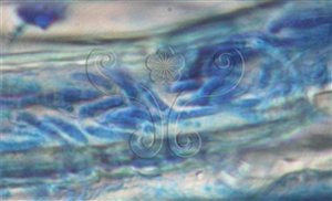 * 圖說：4.光學顯微鏡檢查甘藍黃葉病植株莖基部維管束切片，小孢子在維管束內阻塞的情形。* 作者：莊茗凱、黃振文