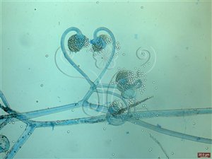 * 圖說：1.Circinella minor (微小卷枝黴)，菌絲上長出孢子囊柄，彎曲，孢子囊壁已破裂，露出內部之中軸與圓形孢子。(棉花藍染色)。* 作者：何小曼