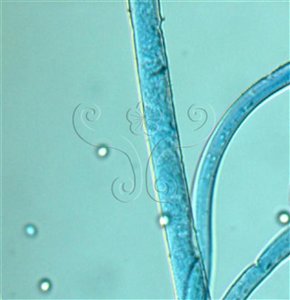 * 圖說：2.Circinella minor (微小卷枝黴)，孢子囊柄彎曲，具有繖型的孢子囊柄分枝，末端長出圓形、多孢子的孢子囊。(棉花藍染色)。* 作者：何小曼