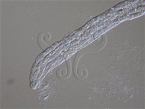* 圖說：3.線蟲體內充滿由菌絲轉化而來之孢子囊。* 作者：陳啟予、郭勤建