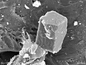 * 圖說：在電子顯微鏡下霰石的微小晶體（拍攝倍率2000倍）* 作者：胡少康拍攝* 智財權：國立自然科學博物館