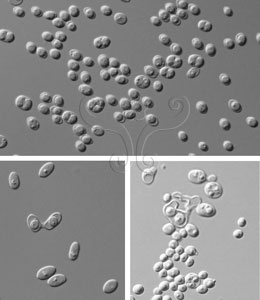 * 圖說：
				4.不同酵母菌的有性生殖產孢方式。上圖中子囊由雙倍體細胞直接轉化發育而成，下圖中子囊由細胞間交配接合所發育而成。