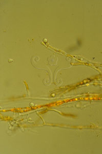 * 圖說：
				1.紅麴菌的菌絲體與分生孢子
